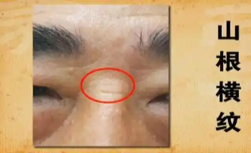 大家都喜欢挺拔的鼻子,高高的山根,显得整个脸庞十分立体而又精致