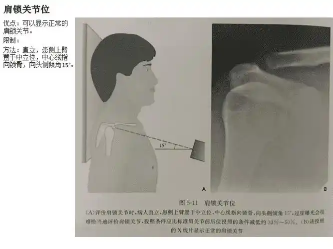 不同肩关节x线投照位