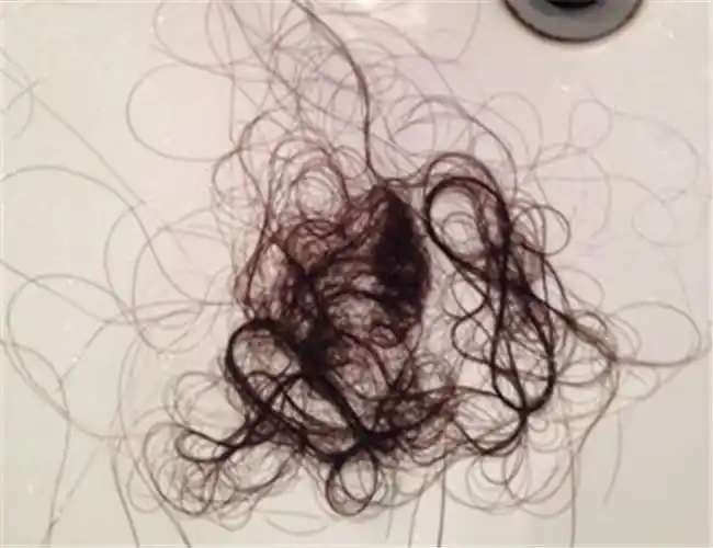 掉头发是女生,和父母最讨厌的问题,每次清理的时候地上一抓一大把又