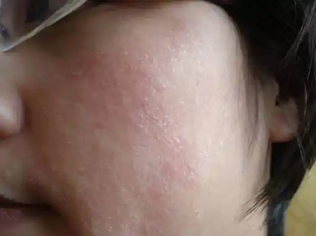 脸干不怪我冬天就酱婶滴姑凉你还要脸不