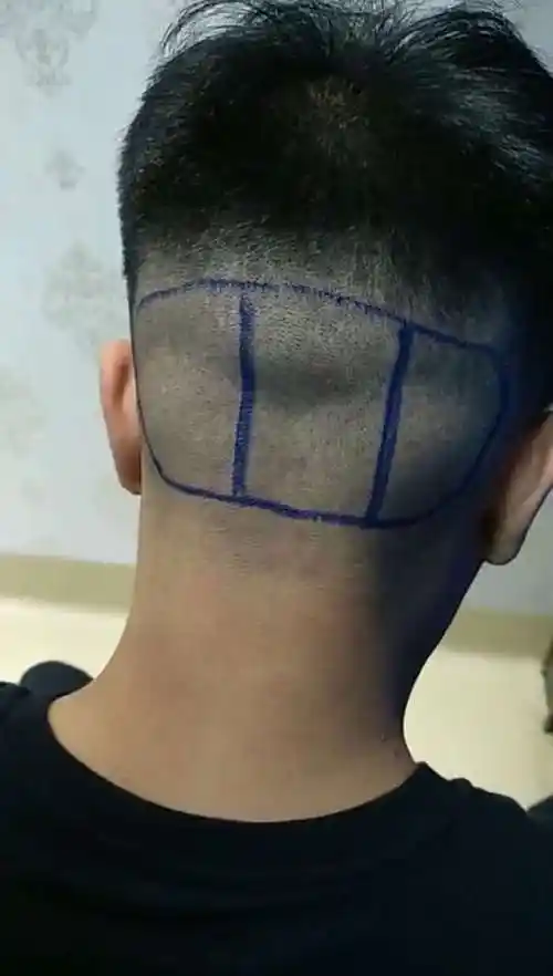 丰富的后枕部资源