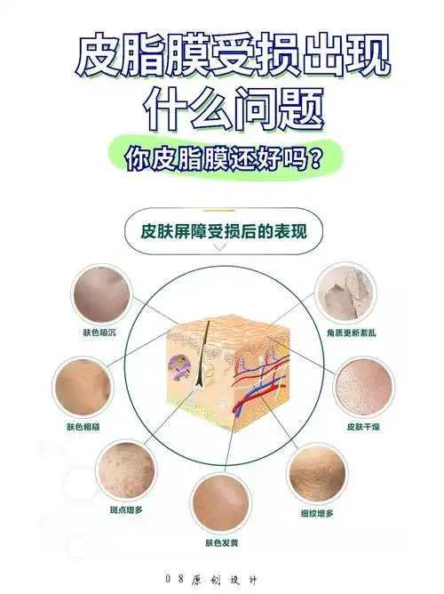 皮脂膜受损出现什么问题.你皮脂膜还好吗?