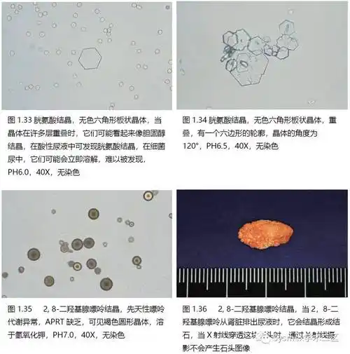尿液结晶形态汇总_sysrnex_学术_来源