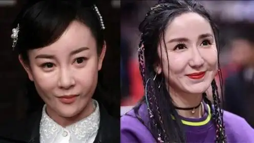 整容失败的五位女星,娄艺潇女神变女鬼,张檬无戏可拍令人惋惜