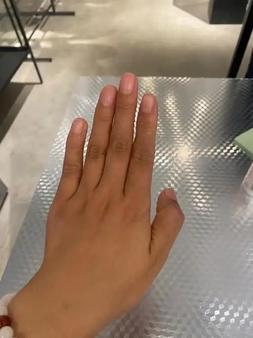 手怎么才能美白啊