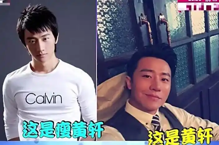 黄轩刚出道时瘦成这样又一戴牙套相当于整容的明星