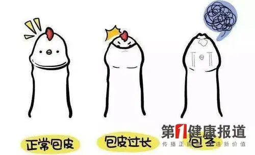 包茎|假期到 要掀开小牛牛的盖头啦