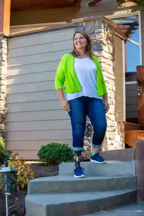 安装假肢需要多少钱|假肢价格|假肢费用|假腿多少钱|假脚板价格