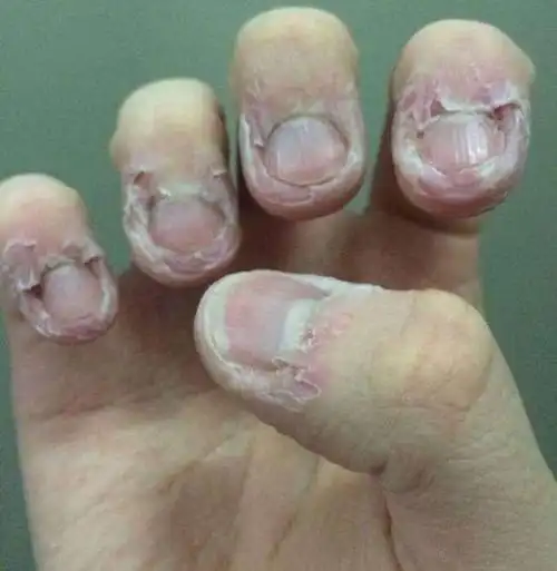 王俊凯鹿晗还在咬手指?我家宝宝长大会不会也这样?