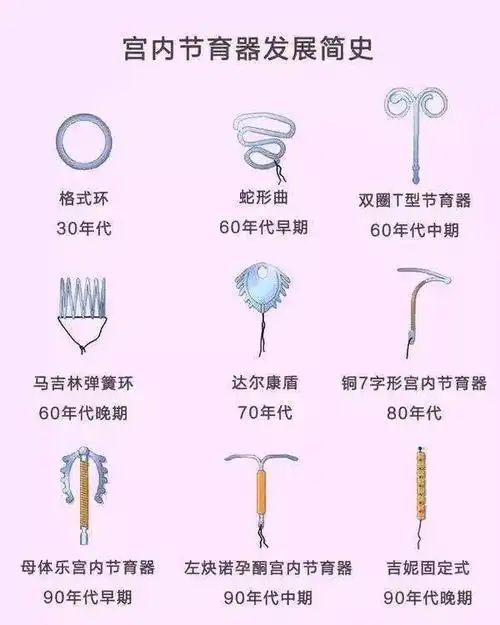 想要二胎取环后总是怀不上怎么回事