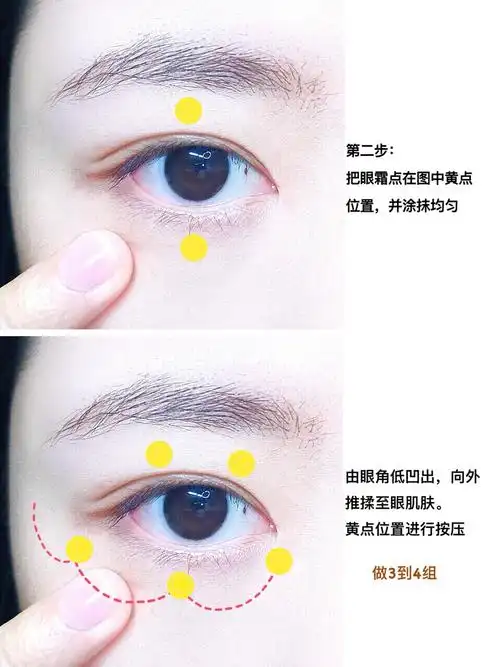 92黑眼圈的眼睑腺堵塞按摩图解眼部黑眼圈眼袋怎么做疏通手法图片