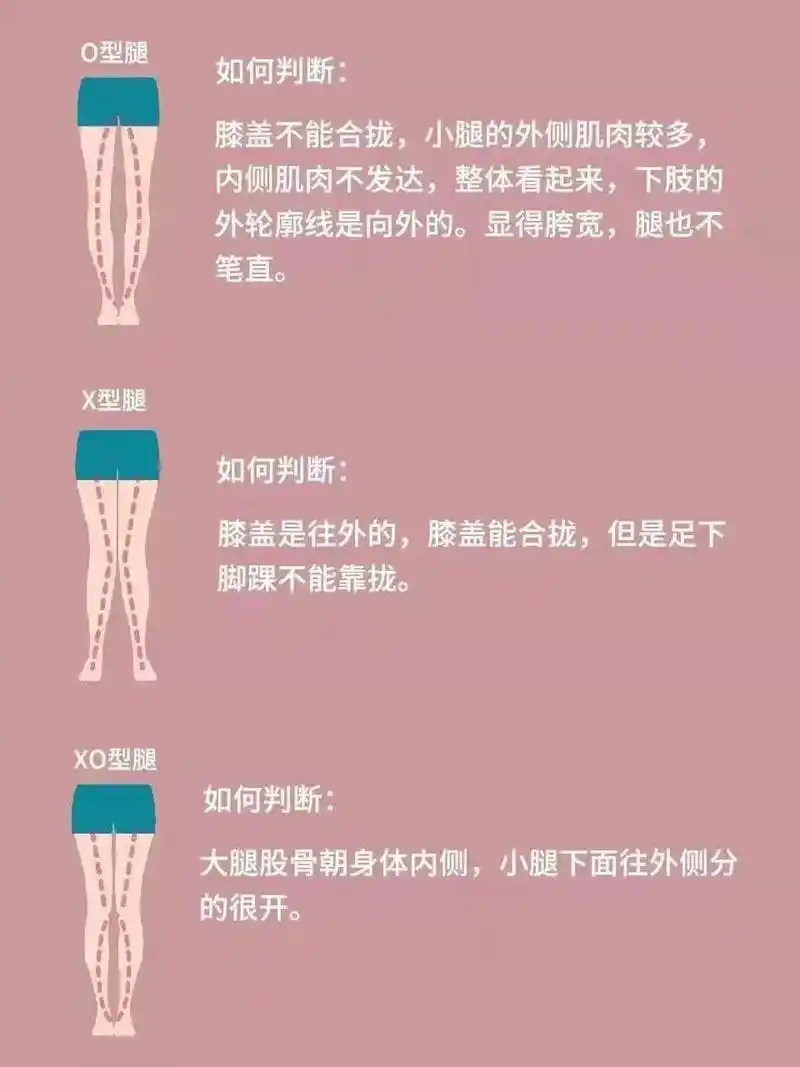 形体仪态知识点分享之腿型矫正