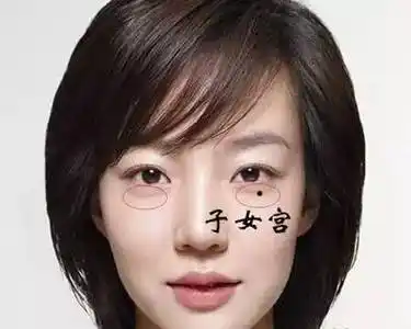 身上有这3处痣,一生劳碌难享福,命苦啊!