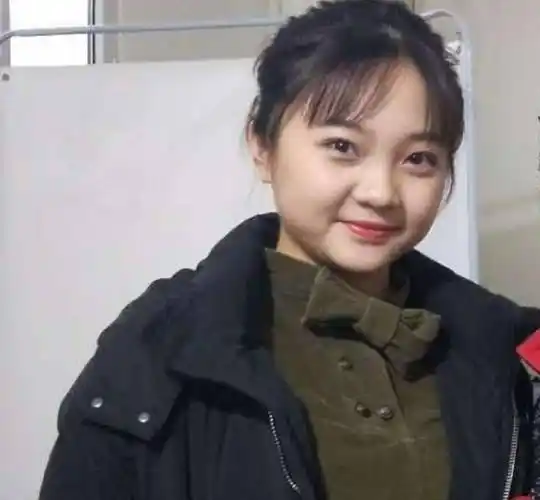 原创21岁林妙可发际线上移露头皮近照曝光引热议网红感太浓