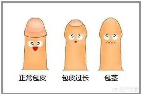 男子包茎手术最佳年龄小孩几岁最适合做包皮手术