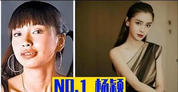 女明星整容前后对比照