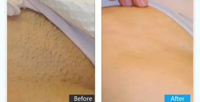 经常看见些八卦杂志说明星穿比基尼的时候没有脱毛,我的天啊,难道她们