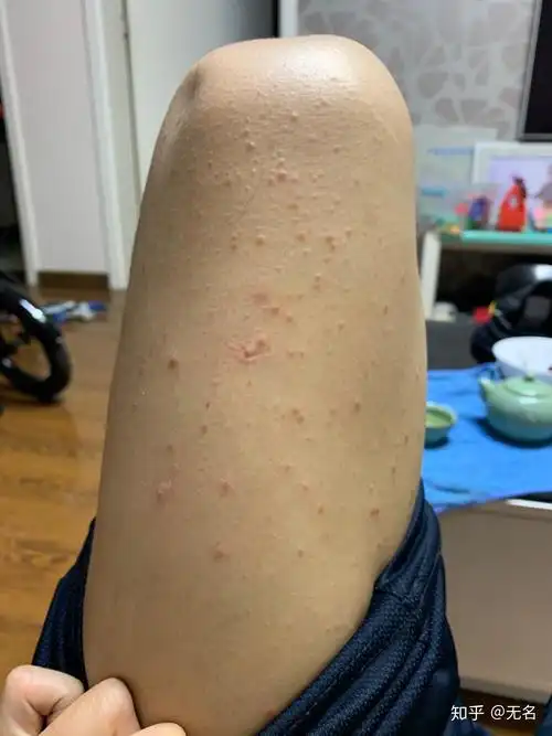 真的不知道我这个是啥问题