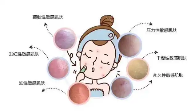 敏感肌和过敏肌傻傻分不清楚怎么办?