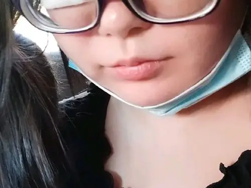 图片无美颜,一千多度近视的金鱼眼让我戴隐形都得带个_圈子-新氧美容