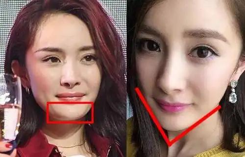 杨幂脸部松垮尖下巴成直线,粉丝说"只是胖了"