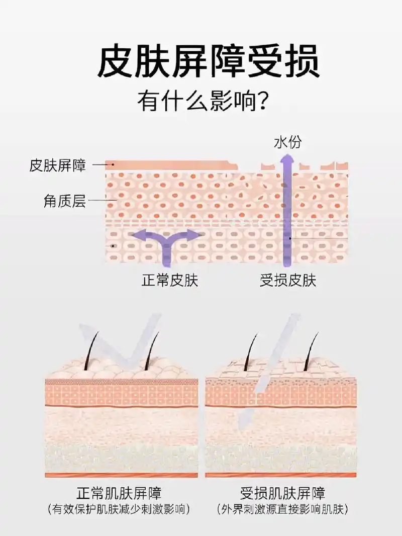 修护屏障如何修复,看完这篇你就知道了|||||皮肤是人体的第 - 抖音