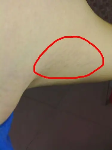 有这么多裂纹啊 开始是紫色 慢慢变浅形成一条条褶皱的皮肤,这是什么