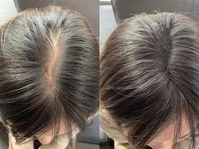 有没有什么好的"生发"产品鸭?自然又减龄,男女通吃的那种!_网易订阅