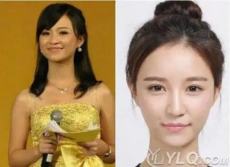 朱宸慧整容前后对比照片朱宸慧为什么叫雪梨