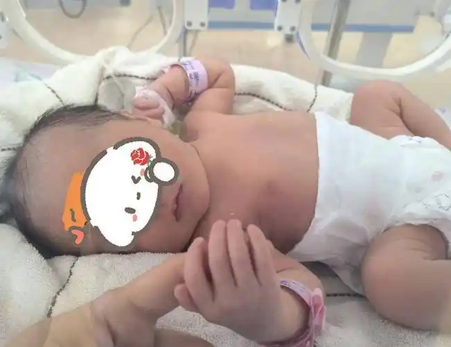 险!孕妈遇上罕见"马方综合征",看他们如何全力守护母子平安