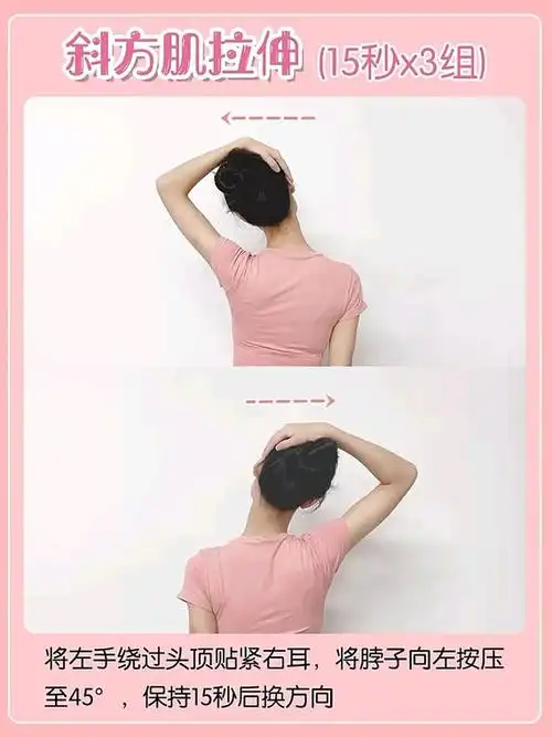 5个动作提升气质/改善斜方肌/get迷人肩颈,好气_圈子-新氧美容整形