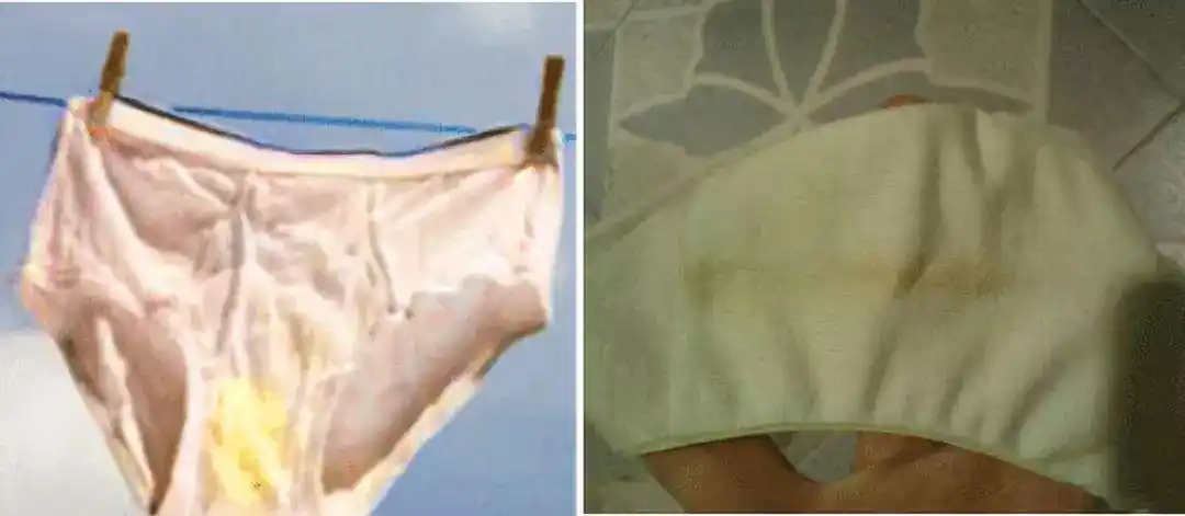 80%妇科病由内裤引起,你还在这样洗内衣裤吗?