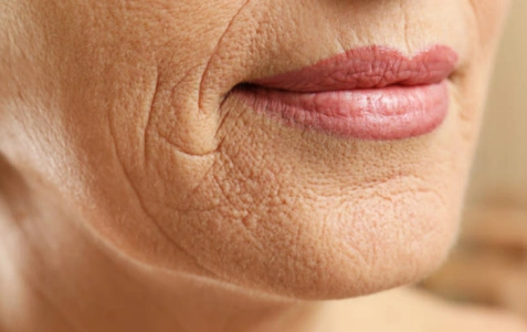 热巴被人吐槽皮肤松弛看小编这几招让你物美价廉的科学抗皱