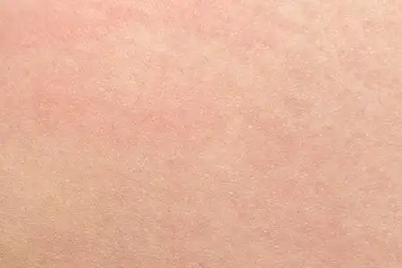 回来保护器图片-回来保护器素材-回来保护器插画-摄图新视界