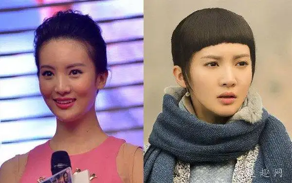 金晨是不是整容了呀金晨的嘴为什么是歪的