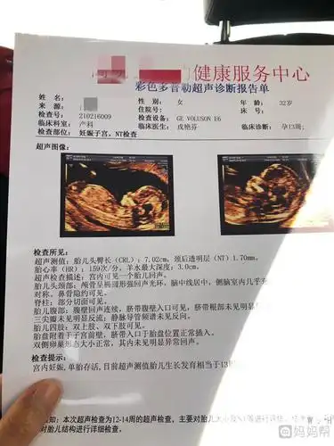 两个大于1一定生男孩nt值看男孩女孩诀窍怎么通过nt看男女性别  这个