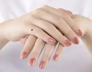 如果小拇指有痣,则代表这个家族会兴旺发达,人丁旺盛,子子孙孙都会