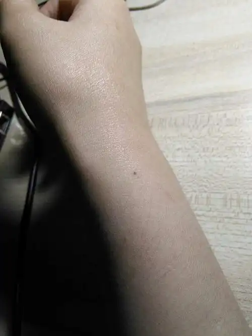 我想找到那个左手腕有颗痣的人