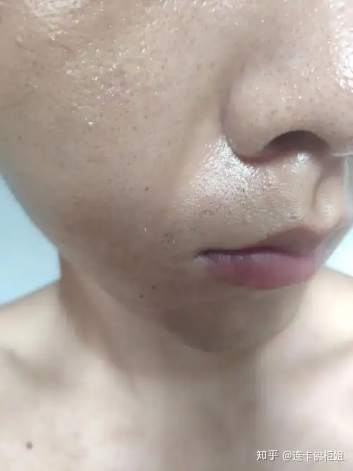 拥有我这种糟心的皮肤该怎么办?