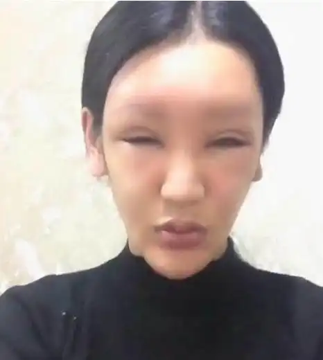 原创女网红沉迷整容却越整越难看近照嘴巴肿成香肠嘴承认自己整容失败