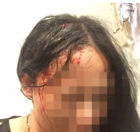 中国女孩头部中枪,鲜血直流.(图片来自网络)