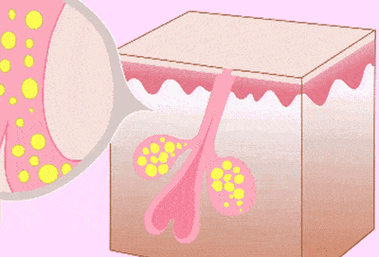 皮肤_油脂_护肤品