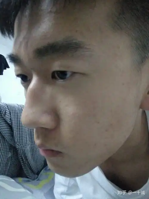 山根低鼻梁高是怎样的体验?