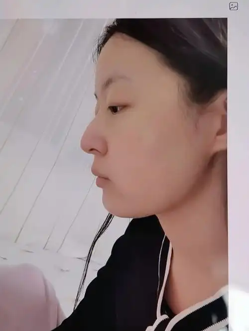 终于知道我的侧脸哪里有问题了