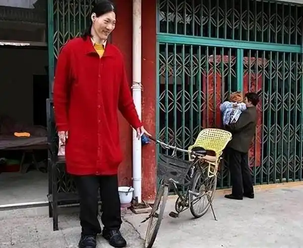 "世界第一女巨人":比姚明高半头,鞋78码,最大的梦想是吃饱饭