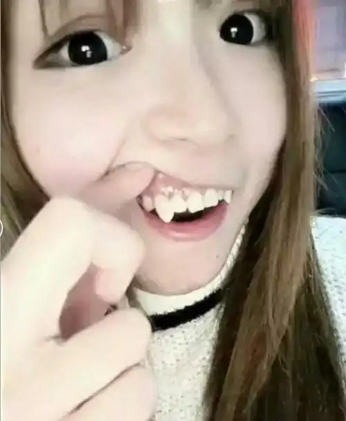 为什么医生警告你别拔虎牙