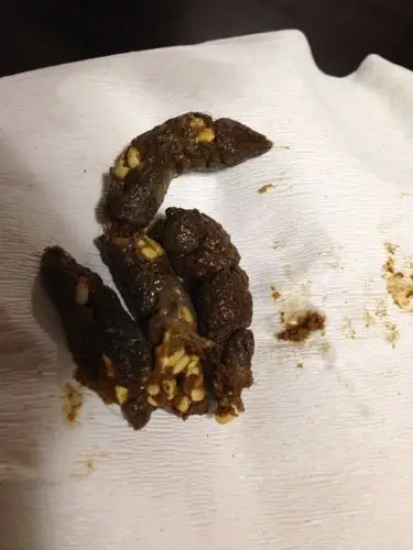 拜托大家看看这是不是绦虫节片,好像不会动.