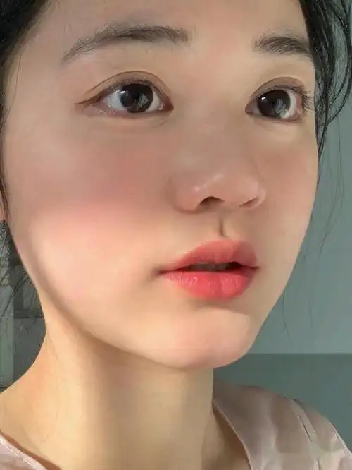 25岁的皮肤状态