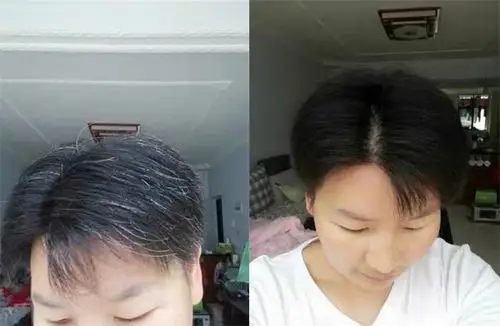 赋美国际研究中心改善好了我的白发