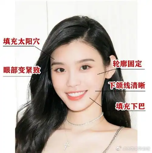 科室新来了一个助理小姑娘,非要拉着我给她分析分析奚梦瑶的变美思路.